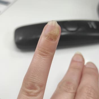 Aymira Koçaklı Yaşam Merkezi Aymira Koçaklı Güzellik Merkezi Tırnak