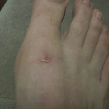 Polaris Ayakkabıda Üretim Hatası!