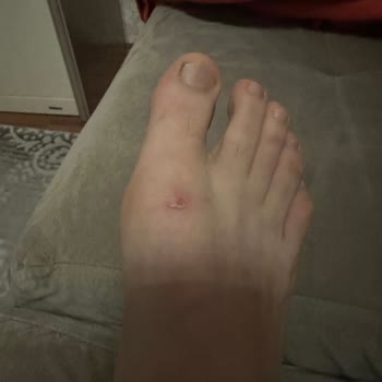 Polaris Ayakkabıda Üretim Hatası!