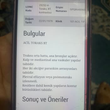 Fethiye Devlet Hastanesi Acil Doktor Şikayeti