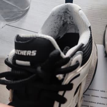 Skechers'ten Aldığım Ayakkabının Arkası 1 Ayda Açıldı