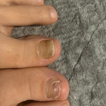 Tamer Tanca Ayağı Mahveden Ayakkabı