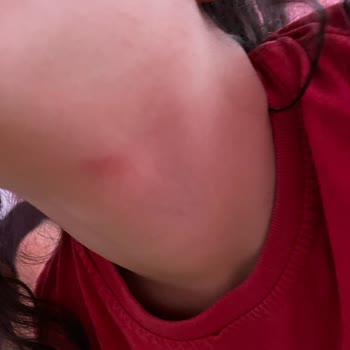 Kiva Kozmetik Barbie Spray Deodorant Yara Yapması