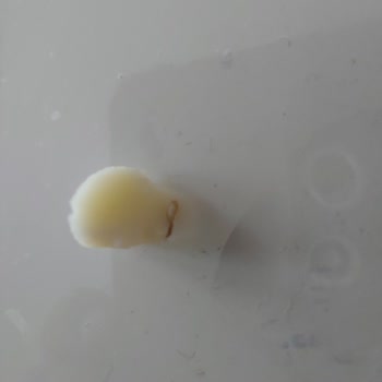 Aknaz Kasar Peynir Binden Alindi