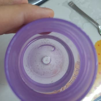 Philips Avent Sulukta Küf Oluyor