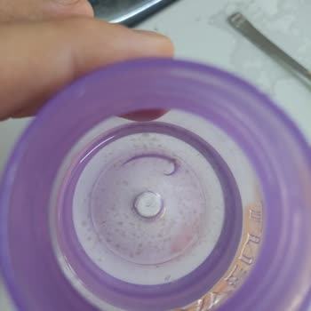Philips Avent Sulukta Küf Oluyor