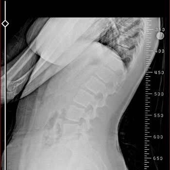 Milli Eğitim Bakanlığı (MEB) Kızımın Sağlık Durumu Nedeniyle Okul Nakli Talebi