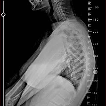 Milli Eğitim Bakanlığı (MEB) Kızımın Sağlık Durumu Nedeniyle Okul Nakli Talebi