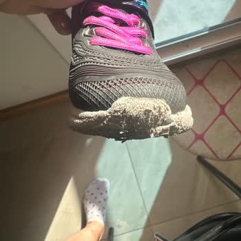 Skechers Ayakkabılarının Kısa Sürede Bozulması