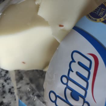 İçim Kaşar Peyniri Den Yabancı Cisim Çıktı