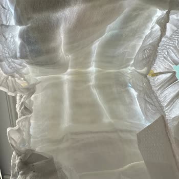 Molfix Yeni Bezin Sızdırma Sorunu