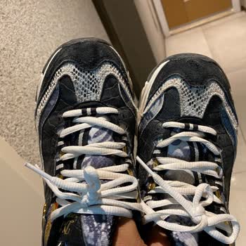 Skechers D Lite Model Pahalı Olmasına Rağmen Kalitesiz Kumaş Yırtıldı