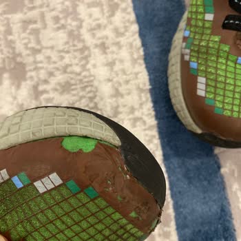 Skechers Ayakkabıda Açılma Oldu