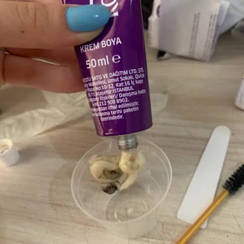 Rossmann'dan Yeni Aldığım Koleston Boya Küflendi