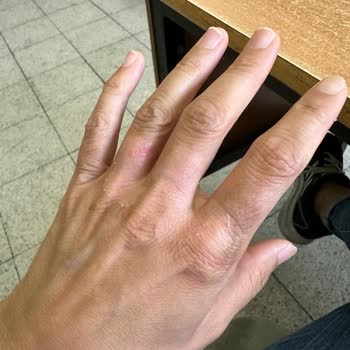 Kumsal Restaurant (Kuşadası) Termoslarıyla Müşteri Yakan İşletme