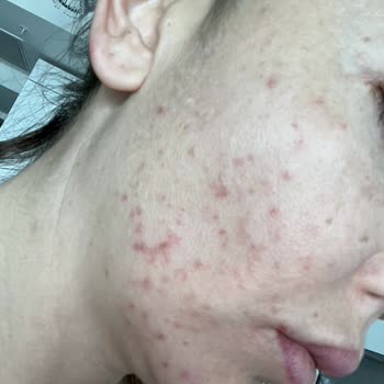 Gratis Bozuk Ürün Nedeniyle Maddi Ve Manevi Zarara Uğradım