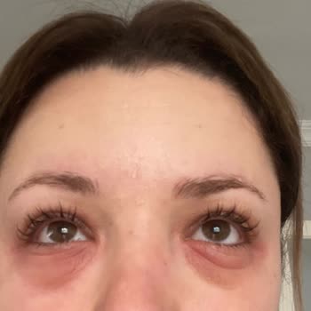 Flormar Göz Alerjisi Kapatıcı