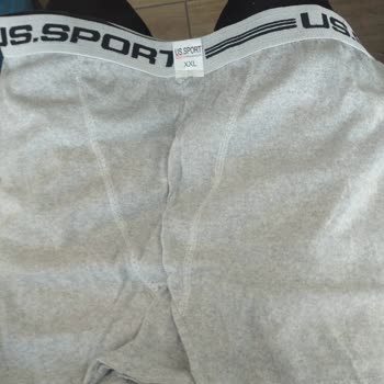 Aras Kargo Ödememi Geri Almak İstiyorum