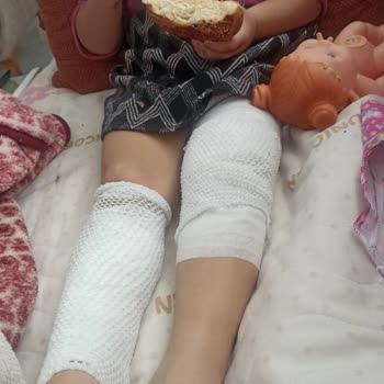 Penguen Home Termos Patladı Çocuğum Yandı