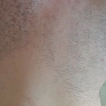 Didem Özkan 4D Kaş Tasarımı ve Güzellik Merkezi Kaş Tasarımı Epilasyon Açıklamayı Okuyun