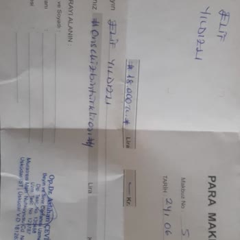 Estpoint Gözlerimde Kalıcı İzler Ve Aşağıya Doğru Açılma Olan Bir Liposuction Ve Alt Göz Kapağı Ameliyatı