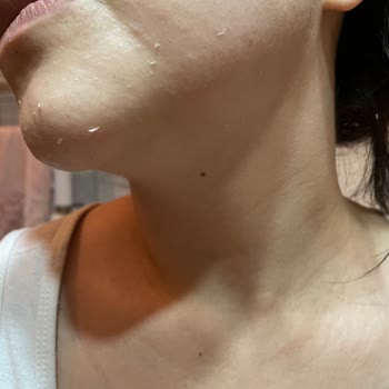 Yves Rocher Cica Krem Pul Pul Dökülme Yaptı