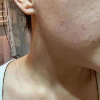 Yves Rocher Cica Krem Pul Pul Dökülme Yaptı