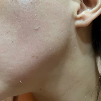Yves Rocher Cica Krem Pul Pul Dökülme Yaptı