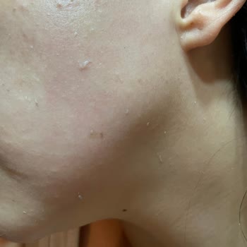 Yves Rocher Cica Krem Pul Pul Dökülme Yaptı