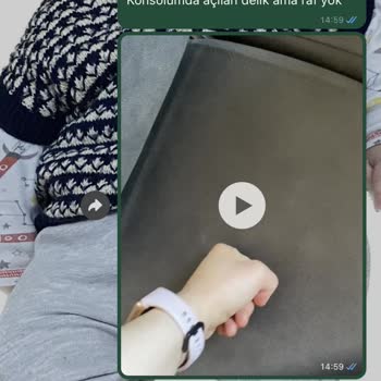 Modalife Ürün Deforme Oldu 1 Sene Geçti Bize Dönüş Yapılmadı