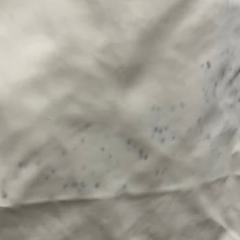 Twist 1 Alışverişte 2 Sorun