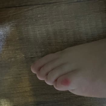 Skechers Çocuk Ayakkabısı Koku Yapıyor