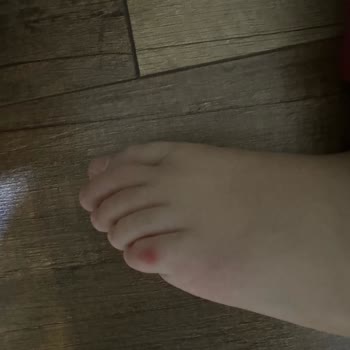Skechers Çocuk Ayakkabısı Koku Yapıyor