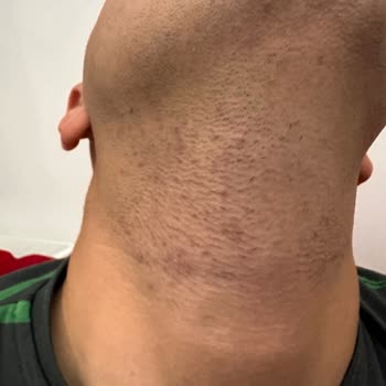 Braun Kişisel Bakım Ürünleri Braun 7 Serisi Yüzümü Çok Tahriş Etmekle Birlikte Sakal Çok Bırakıyor