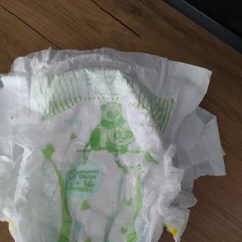 Bebem Natural Bezde Siyah Sert Bir Şey Var