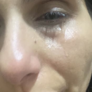 Opticsunn Alışverişimle İlgili Sorun