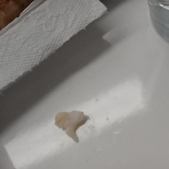 Lezita Hindi Fümeden Kemik Çıktı