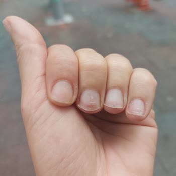 Aika Nail & Hair Studio Verilen Hizmetin Hizmetten Uzak Ve Zarar Vermek Oluşu