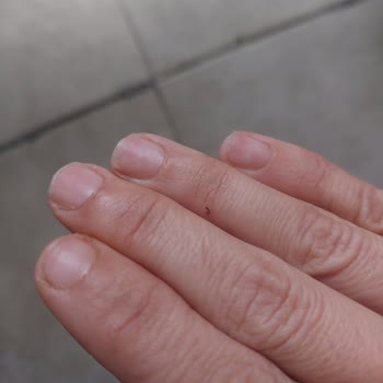 Aika Nail & Hair Studio Verilen Hizmetin Hizmetten Uzak Ve Zarar Vermek Oluşu