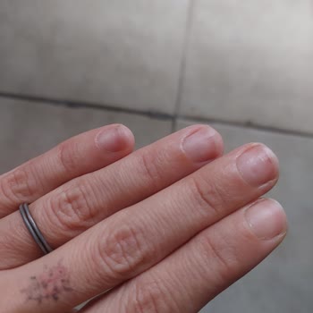 Aika Nail & Hair Studio Verilen Hizmetin Hizmetten Uzak Ve Zarar Vermek Oluşu