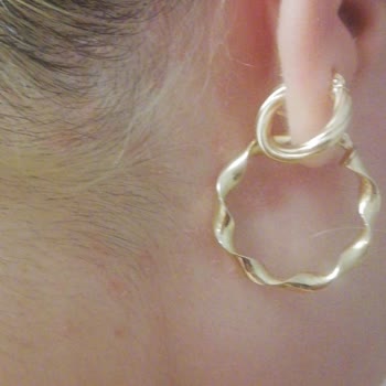 Yves Roche Şampuan Saç Derime Egzama Yaptı