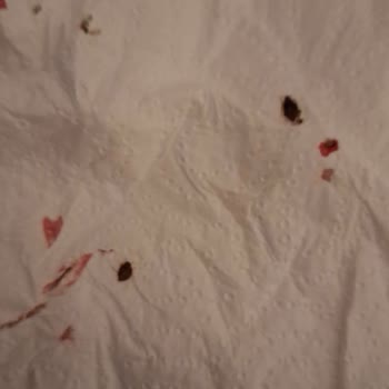 Bambi Yataktan Tahtakurusu Çıktı