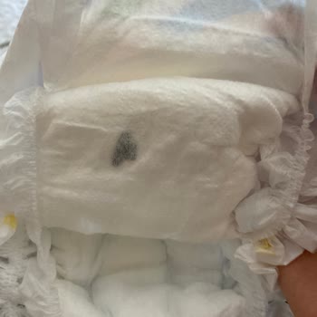 Molfix Bezin İçindeki Siyah Şey