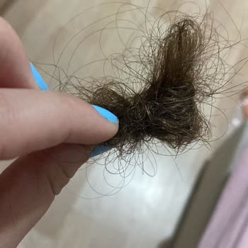 Trendyol Saç Bakım Ürünleri Saç Dökülmesine Sebep Oldu