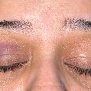 Şok Marketler   Kasiyeri Ve Kocası Tarafından Darp Edildim