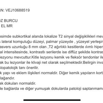 İzmir Katip Çelebi Üniversitesi Atatürk Eğitim ve Araştırma Hastanesi Patoloji Kaybolması Ve Sonuçlanmaması