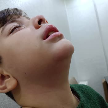 Alfemo Yemek Sandalyeleri Kırılıyor