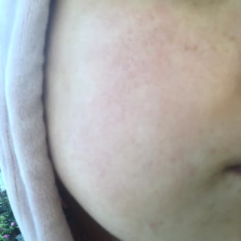 La Roche - Posay Cilt Bakım Ürünlerinde Beklenmedik Tepki!