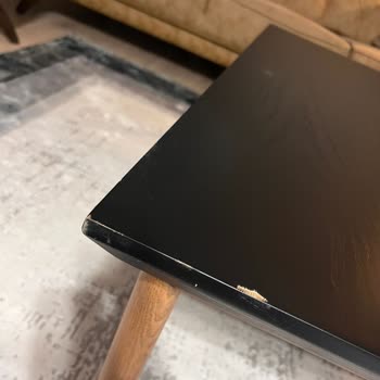 Şikayetim Var Vivense Den