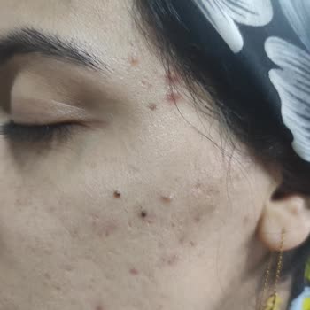 New Well Probiyotik Nemlendirici Krem